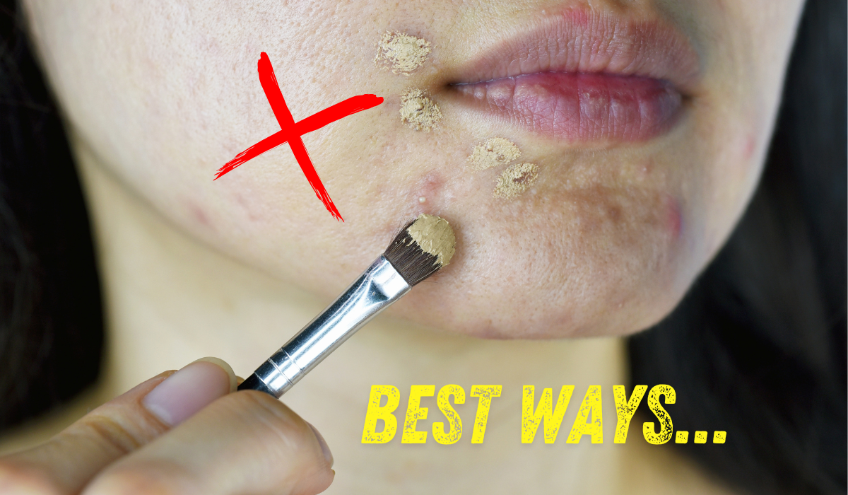 Hide Pimples Without Makeup